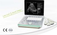 CHOGRAPHIE ABDOMINALE
